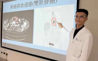 菸酒不離身 68歲台商驚罹雙原發癌
