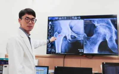 婦股骨缺血壞死 中慈減壓術保髖關節