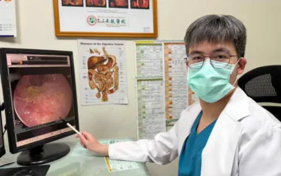 婦健檢意外發現大腸癌前病變 內視鏡黏膜下剝離術免切腸