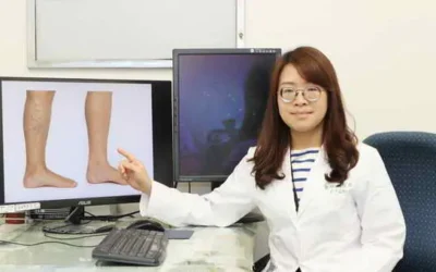 久站雙腿腫脹 微創重返輕盈步伐
