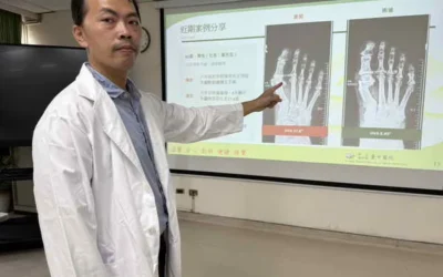 登山男兩度拇指外翻 截骨矯正術治癒