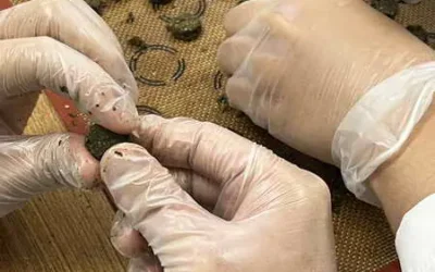 三伏天用三伏貼 治療過敏性鼻炎有效