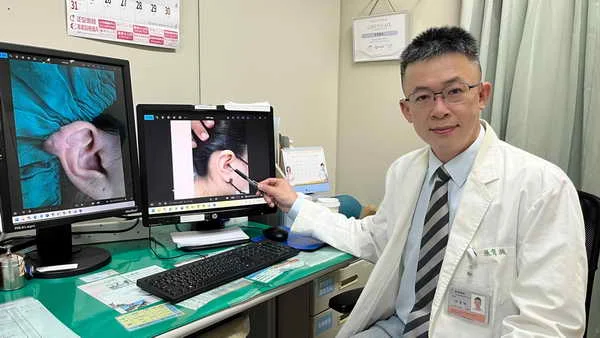 女大生穿耳洞 耳廓長出如尖尖1