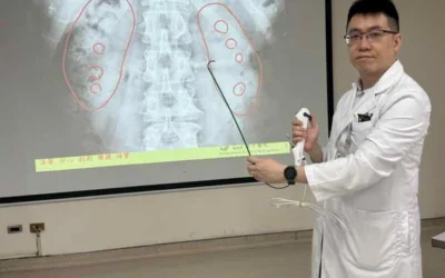 雷氏斑作祟 腎臟像長滿葡萄乾的雜糧麵包