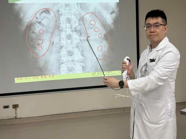 雷氏斑作祟 腎臟像長滿葡萄乾的雜糧麵包