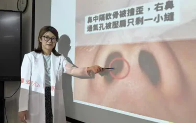 蘋果姐姐鼻子撞歪 鼻整形術回復堅挺