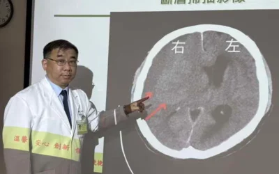 忙到半邊無力!攤商「亞急性腦出血」