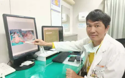 女嬰臀部罕見長「大球」畸胎瘤切除
