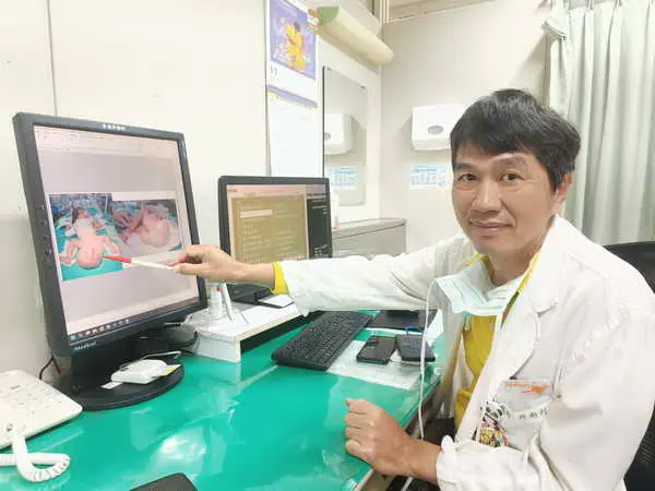 女嬰臀部罕見長1