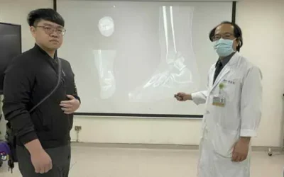 嚴重骨折「雙壓」治療 讓他倆返職場