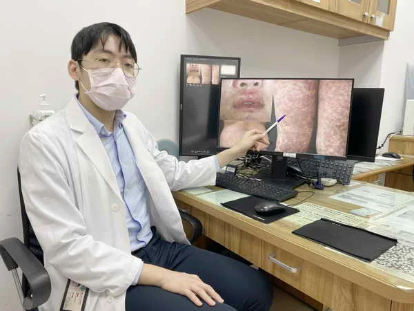 中榮免疫與基因檢測 揪出嚴重致敏藥物1