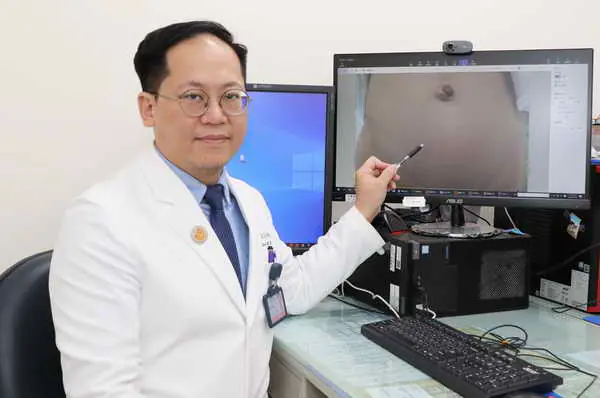 4歲男童得疝氣 單孔微創手術無疤痕1