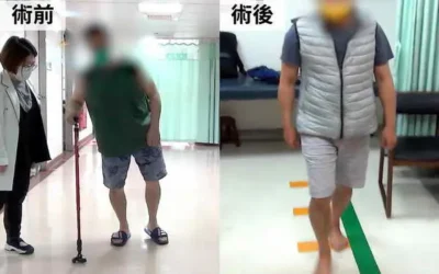 清醒手術助攻 彰基成功執行精準帕金森氏症DBS療法
