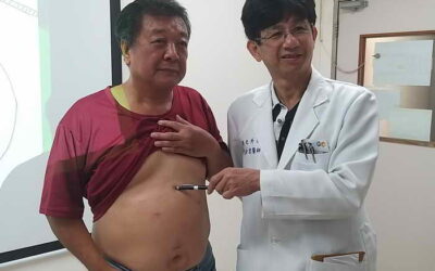 不屬牛卻一吃就反芻! 困擾逾50年的老毛病因這「微創三合一手術」治好了