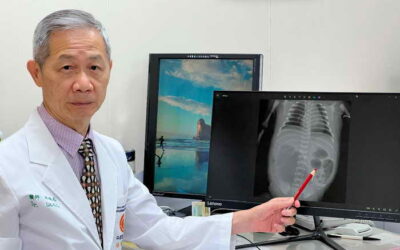 出生嬰兒先天迴腸閉鎖命垂危 跨科醫療救回