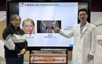 女長期單側頭痛加眼睛痛 竟是鼻竇腫瘤惹的禍