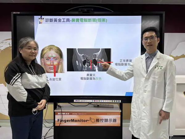 女長期單側頭痛加眼睛痛 竟是鼻竇腫瘤惹的禍1