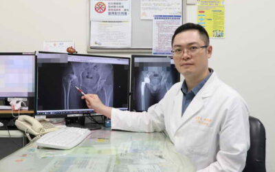 擺脫兒時陰影 微創正前開人工髖關節手術助赴美圓夢