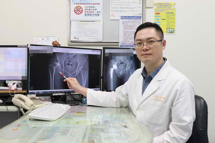 擺脫兒時陰影 微創正前開人工髖關節手術助赴美圓夢1