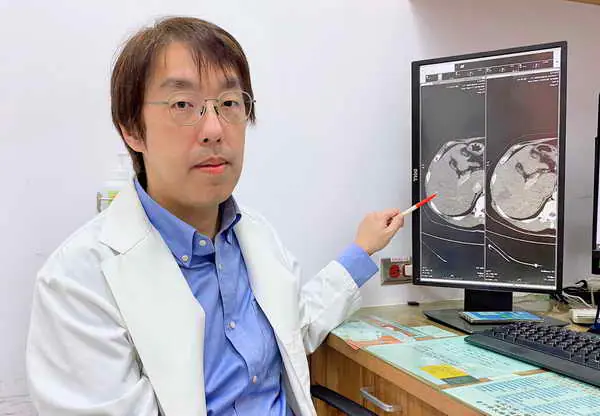 早期肝癌免開刀 射頻或微波治療效果好1