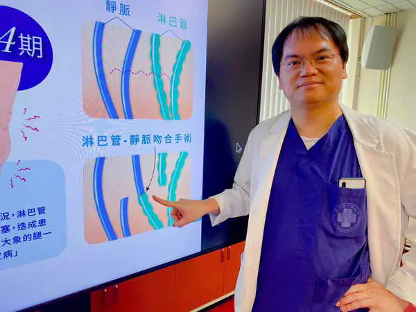 癌後淋巴水腫有解 超顯微手術助上百患者重返常軌1