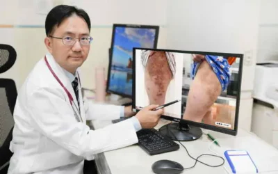 童重度異位性皮膚炎 新療法治癒紅疹搔癢