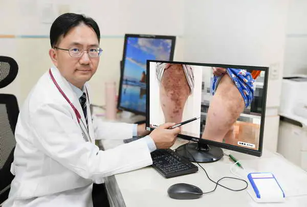 童重度異位性皮膚炎 新療法治癒紅疹搔癢1