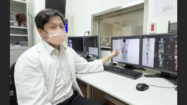 老翁食道癌六年後復發 光子刀放射治癒