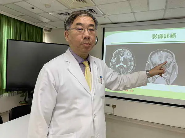 能言善道變沉默哥 手腳突無力竟是腦瘤作祟1